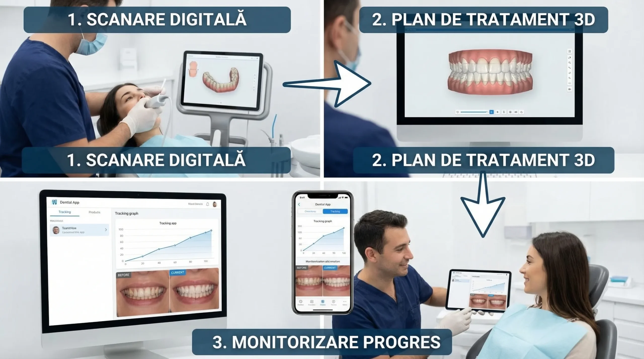 Ilustrație cu un flux simplificat al planificării digitale 3D în ortodonție: scanare dentară, plan de tratament pe model 3D, monitorizare periodică a progresului.